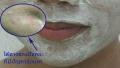 Beauty Test ดินสอพองพอกหน้า ทุเลาสิวอักเสบได้จริงหรือ?