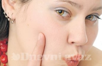 Kako smanjiti proširene pore na licu