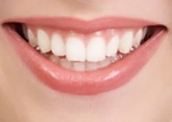 Những mẹo vặt giúp bạn có hàm răng trắng cho nụ cười tỏa nắng.